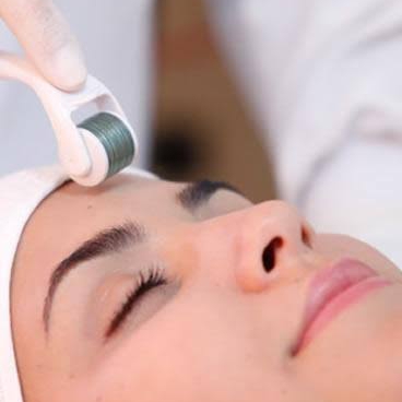 Limpeza de pele+ Microagulhamento Drug-delivery