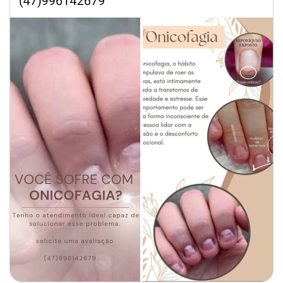 Manutenção Fase 1 Onicofagia