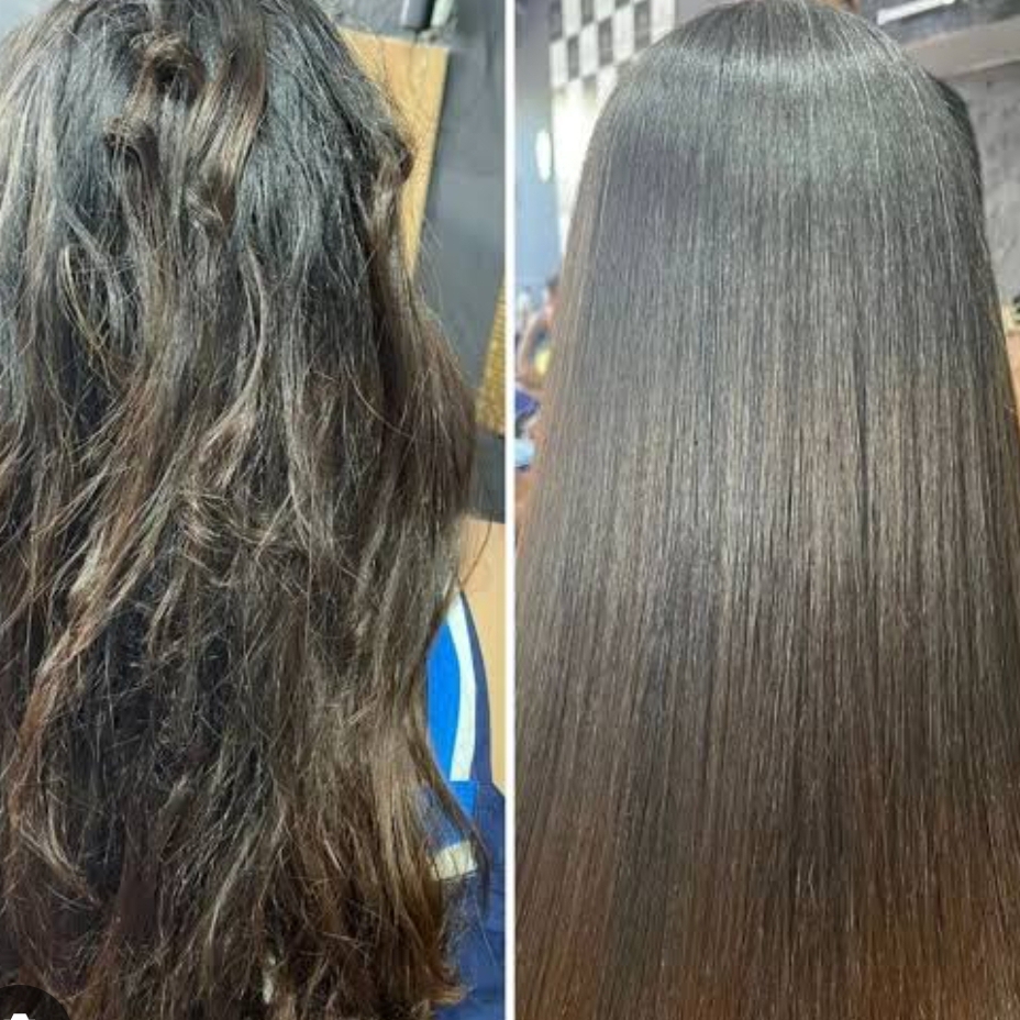 Tratamento de cauterização