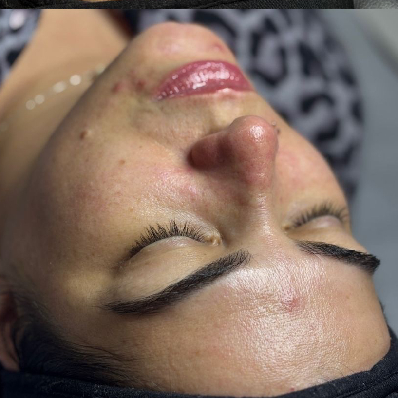 1 - Jato de Plasma Preparação