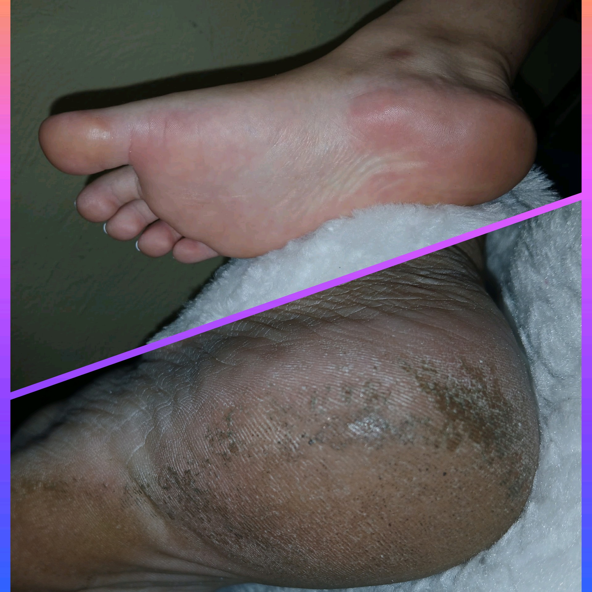 Spa dos Pés + Pedicure