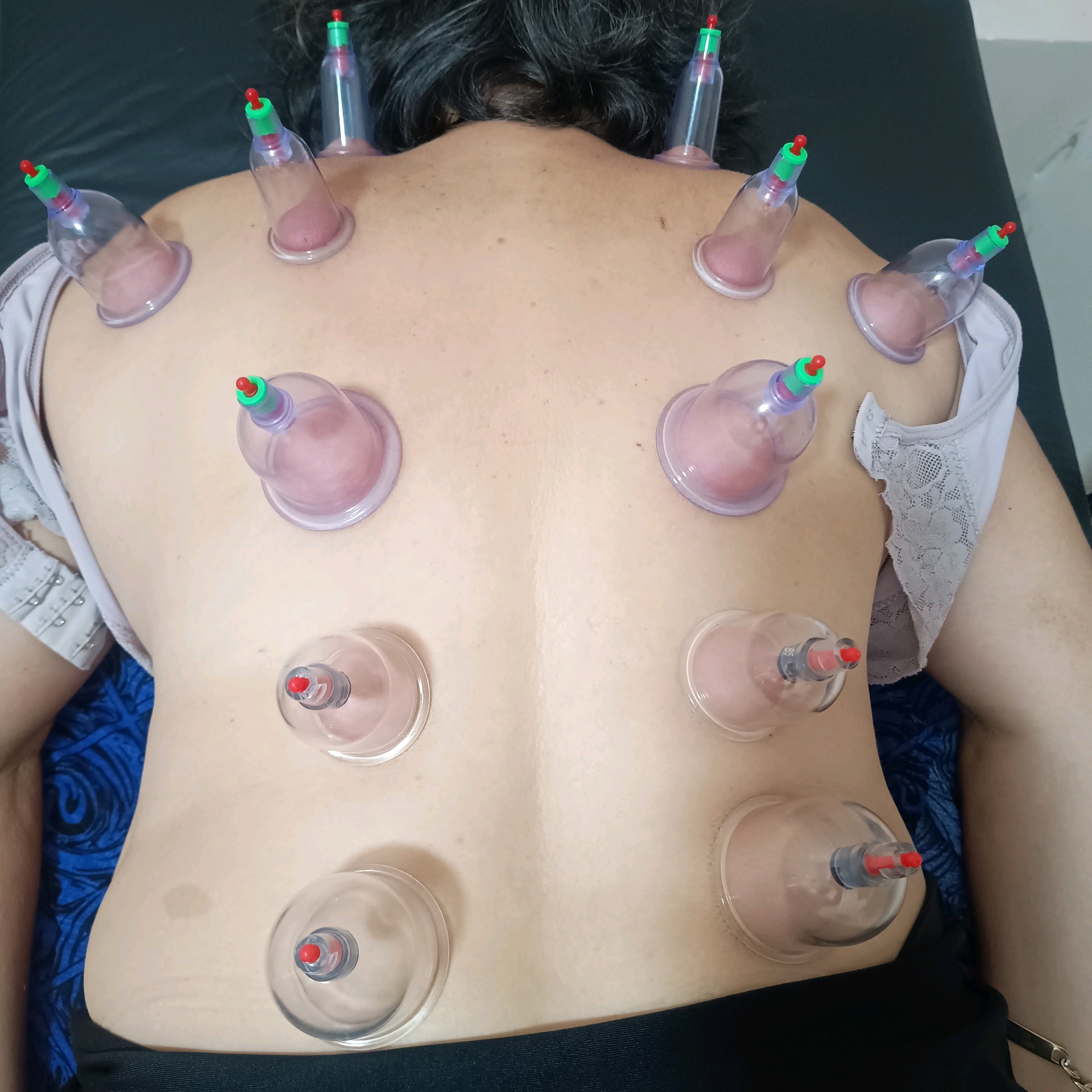 Liberação Miofacial Pacote intensivo