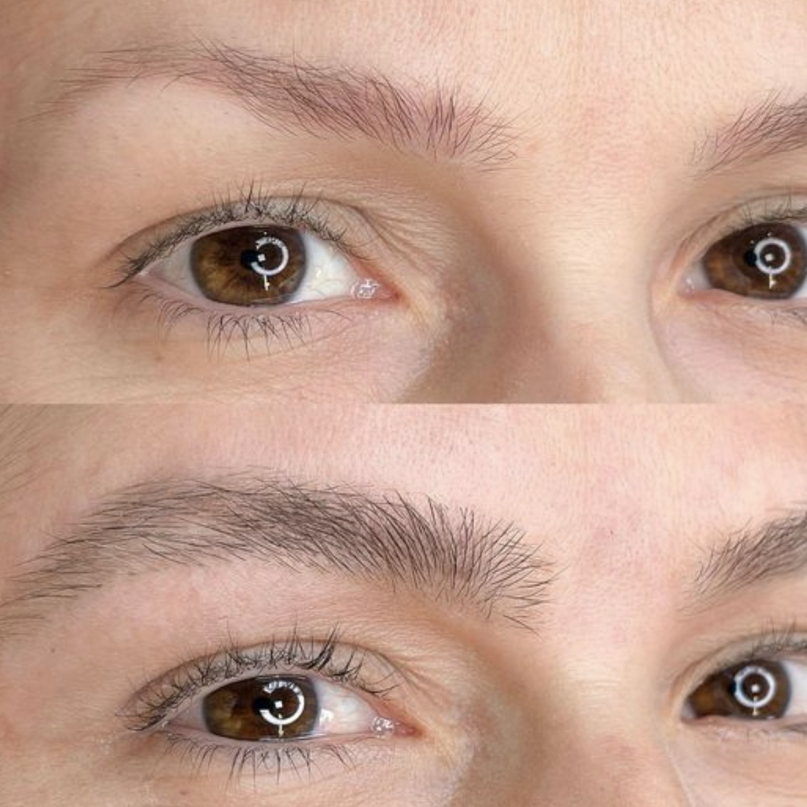 reconstrução de sobrancelha para crescer pelos