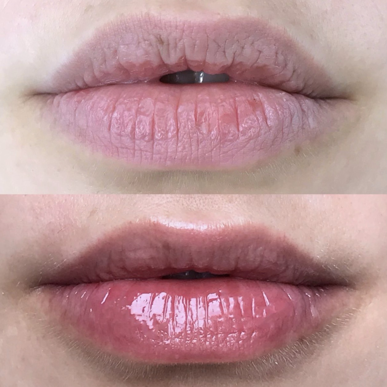 hidratação labial