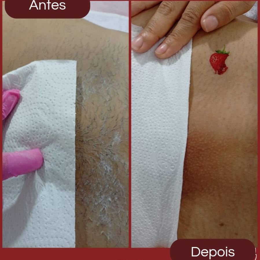 depilação intima feminina comple