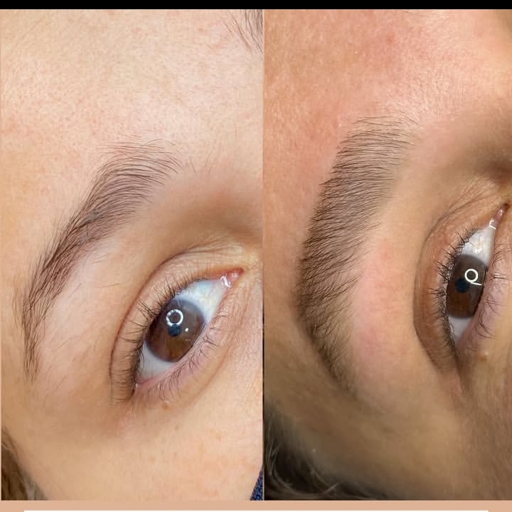 Design Reconstrutivo (incluso argiloterapia)