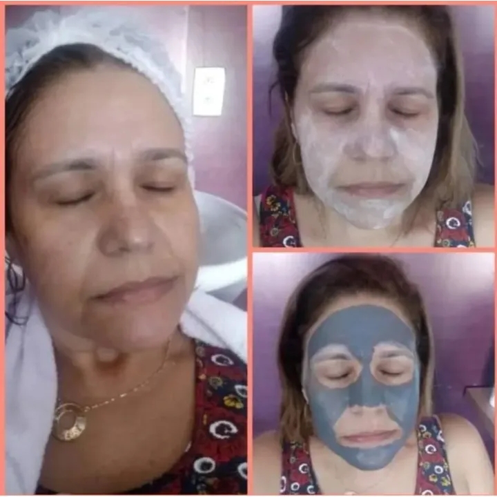 limpeza de pele Premium(limpeza+esfoliação+máscara+extração+tonificação+hidratação)