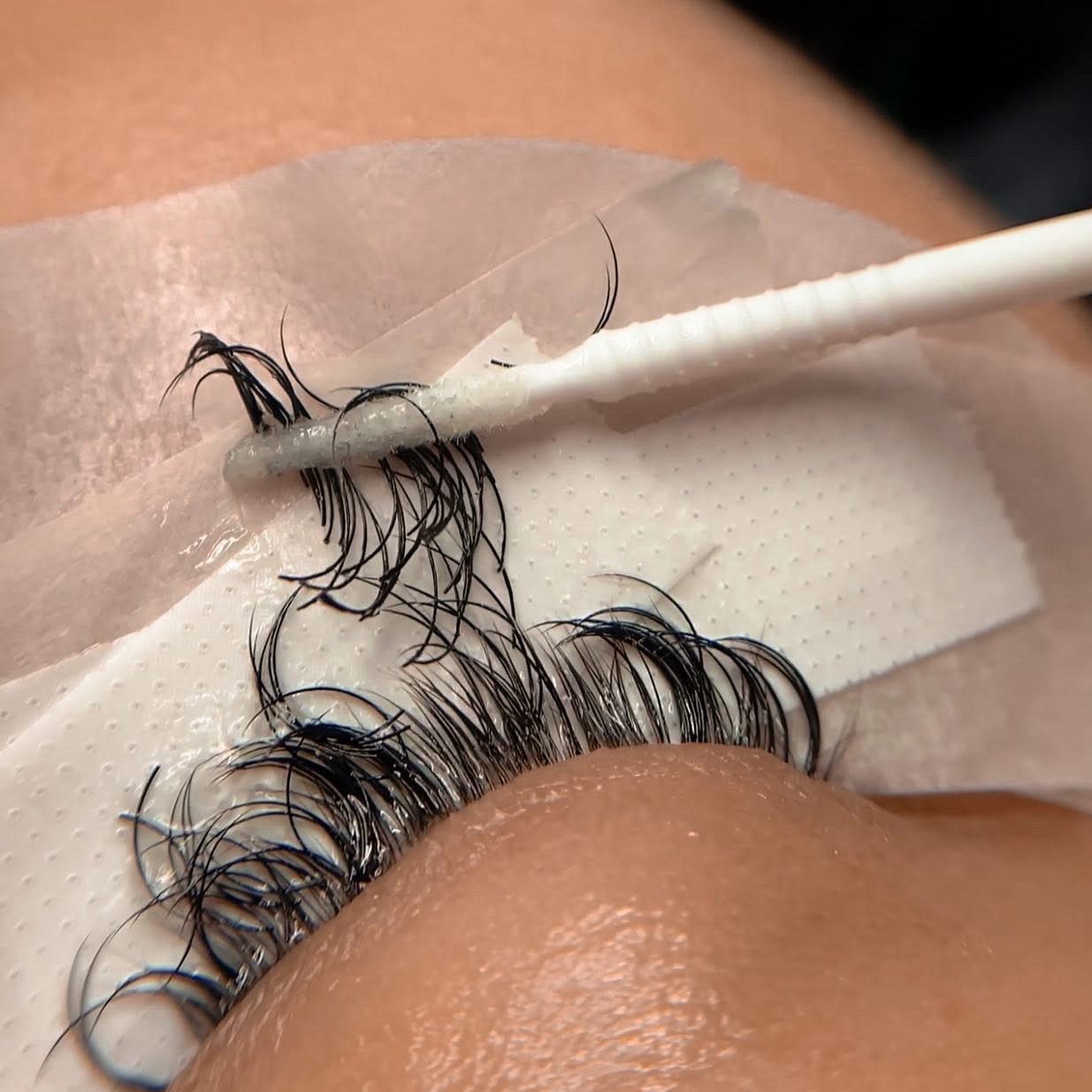 REMOÇÃO DE CÍLIOS