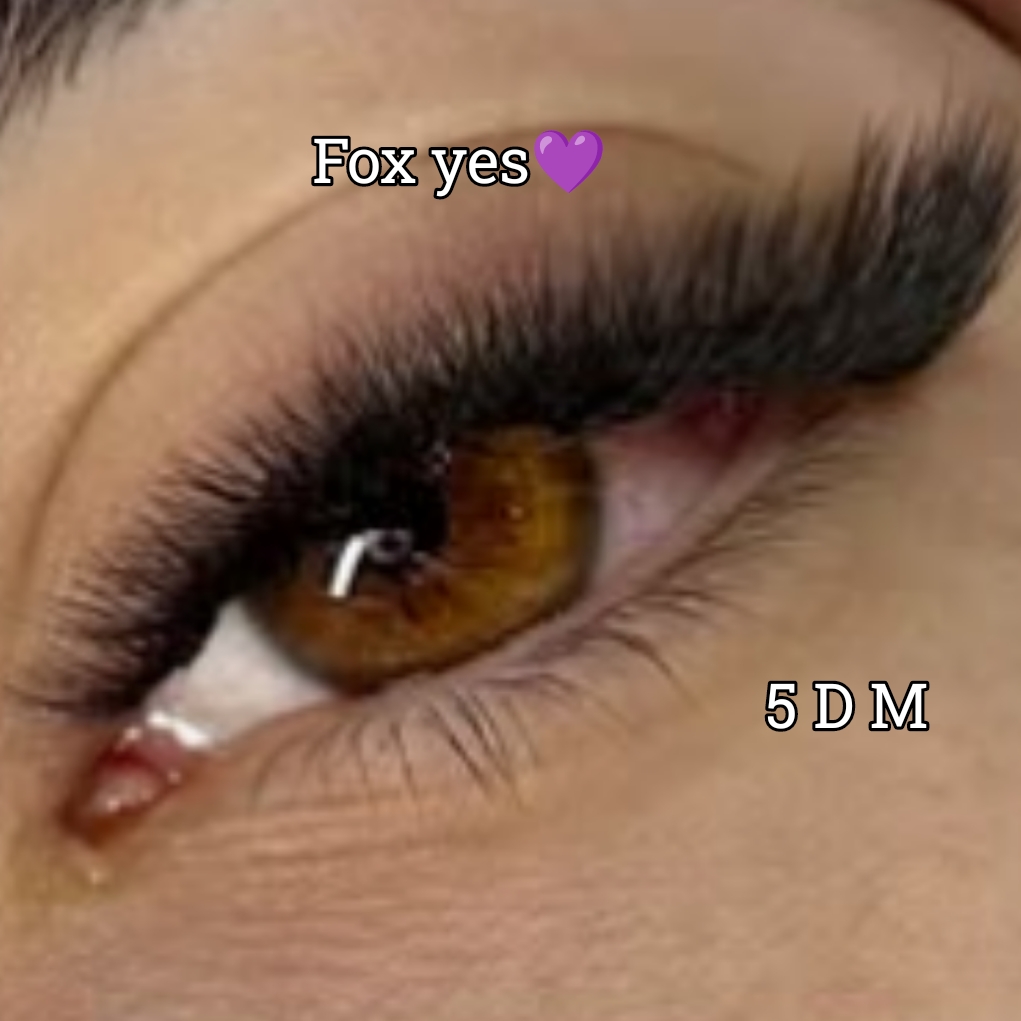 Fox yes                                     (Manutenção R$125,00)                                    ( manutenção R$90,00).