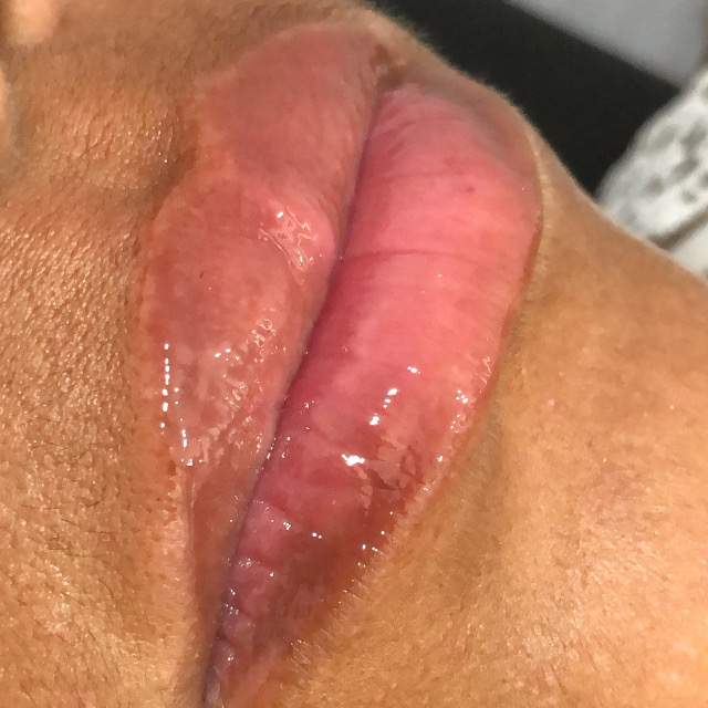 Spa Labial com Massagem