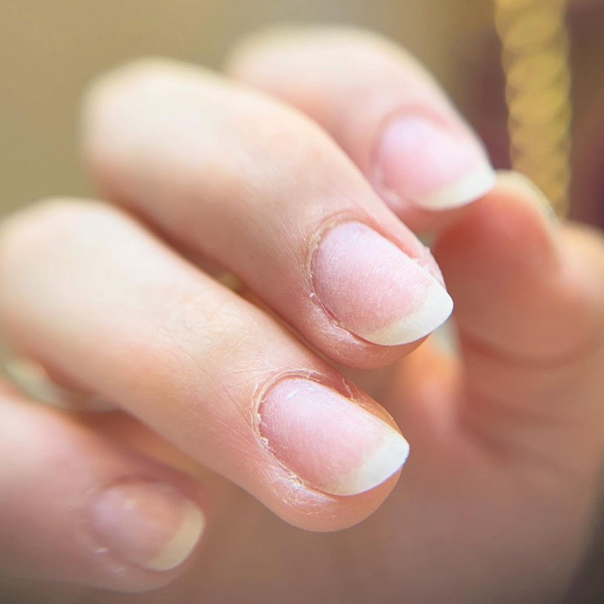 remoção de alongamento