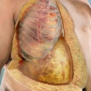 tecido adiposo resistente