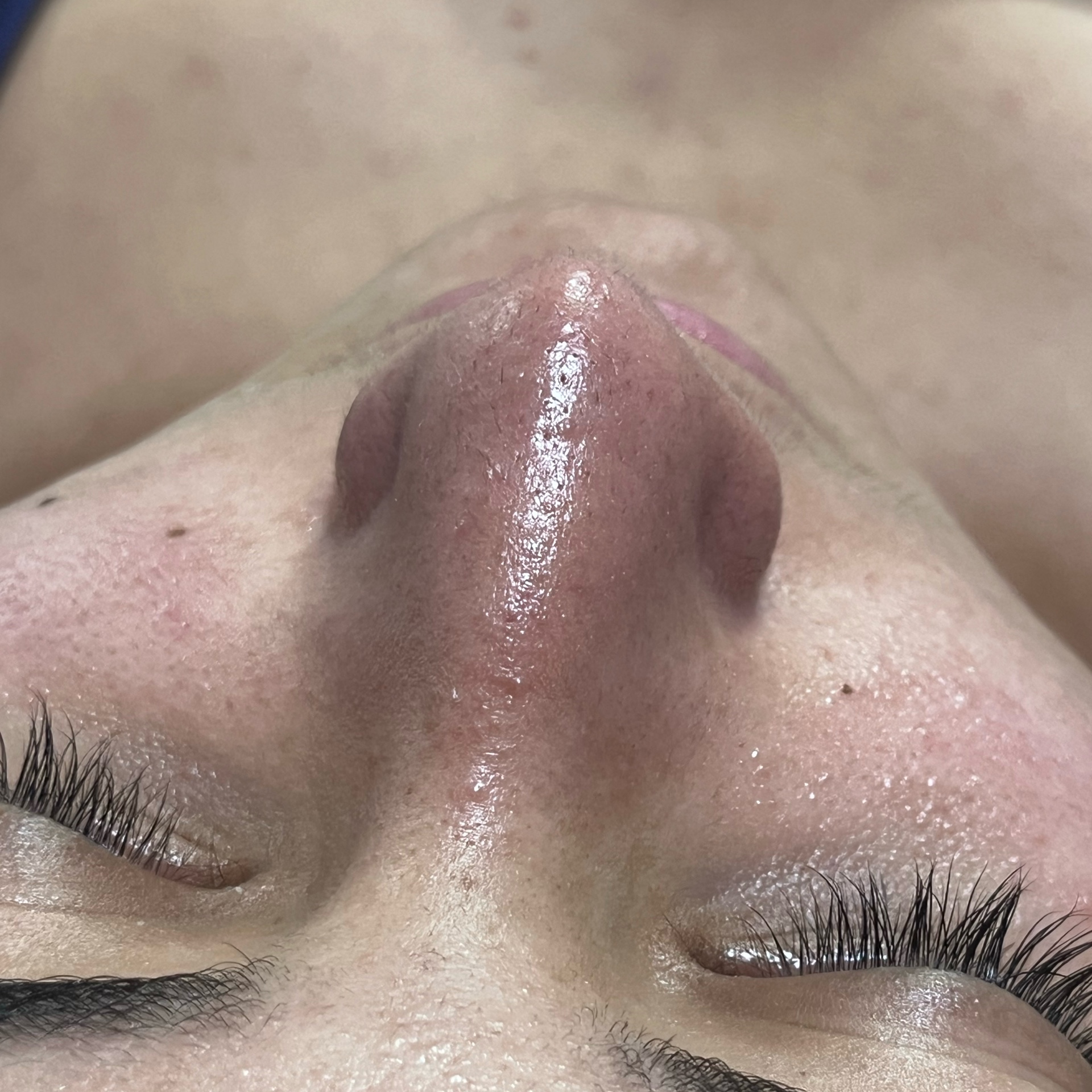 Limpeza de pele personalizada