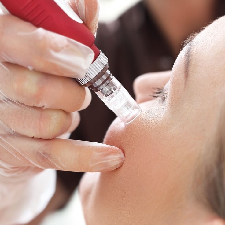 Biorevitalização Facial