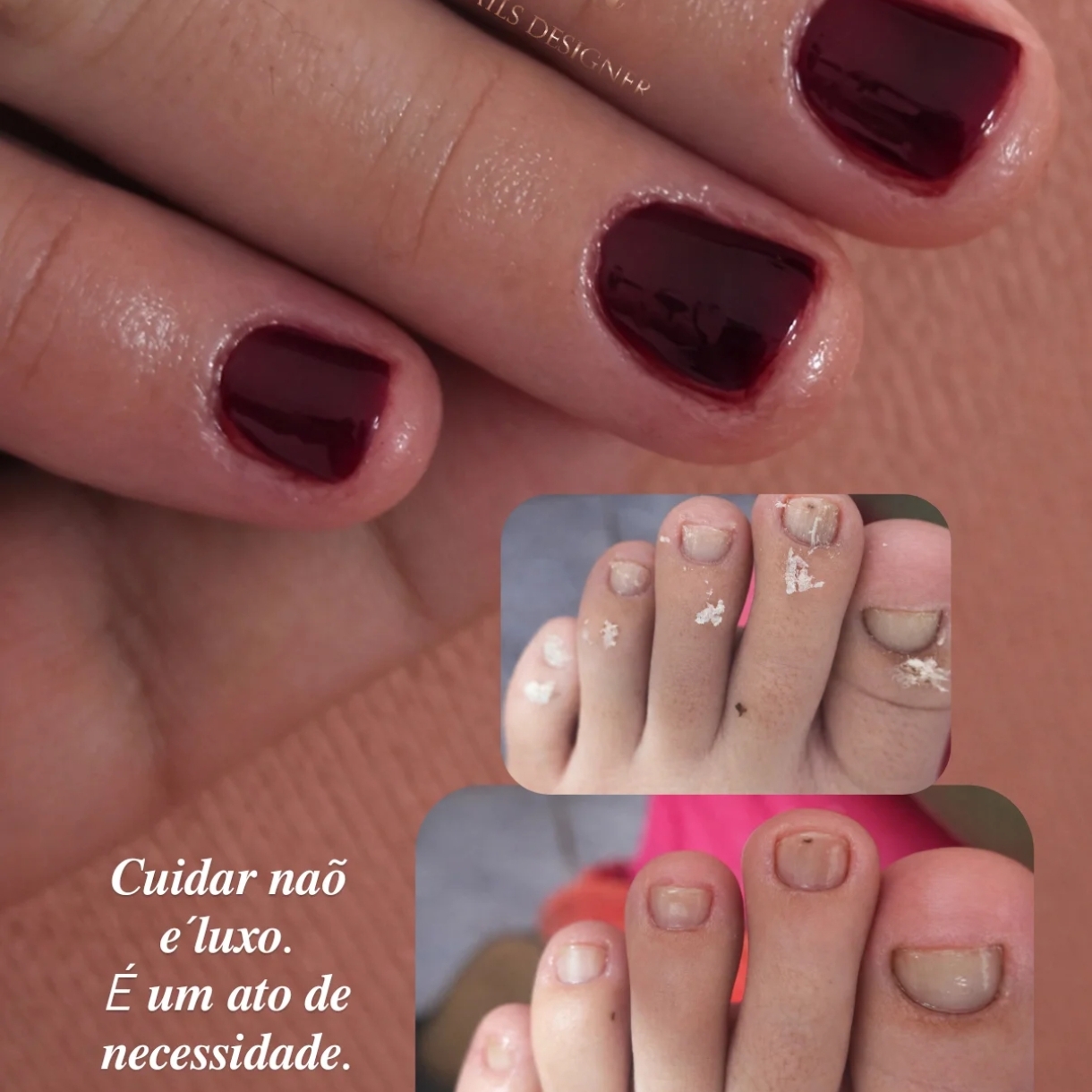Manicure