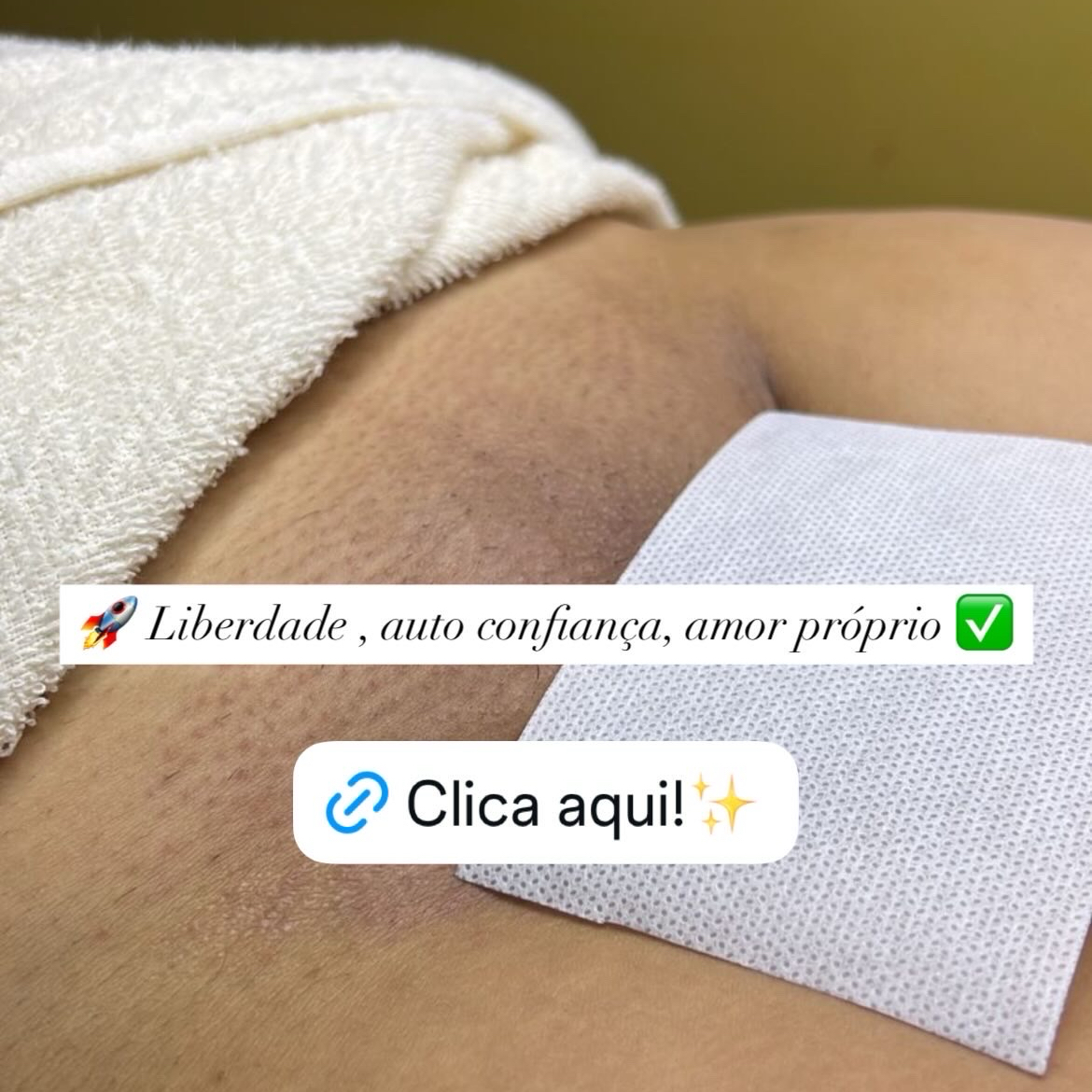 Epilação Contorno Completo