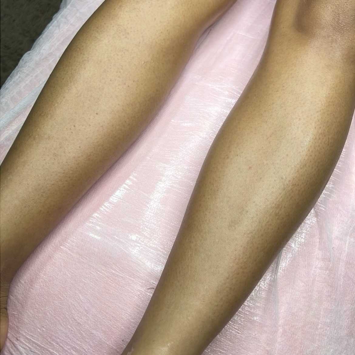 Epilação Meia perna