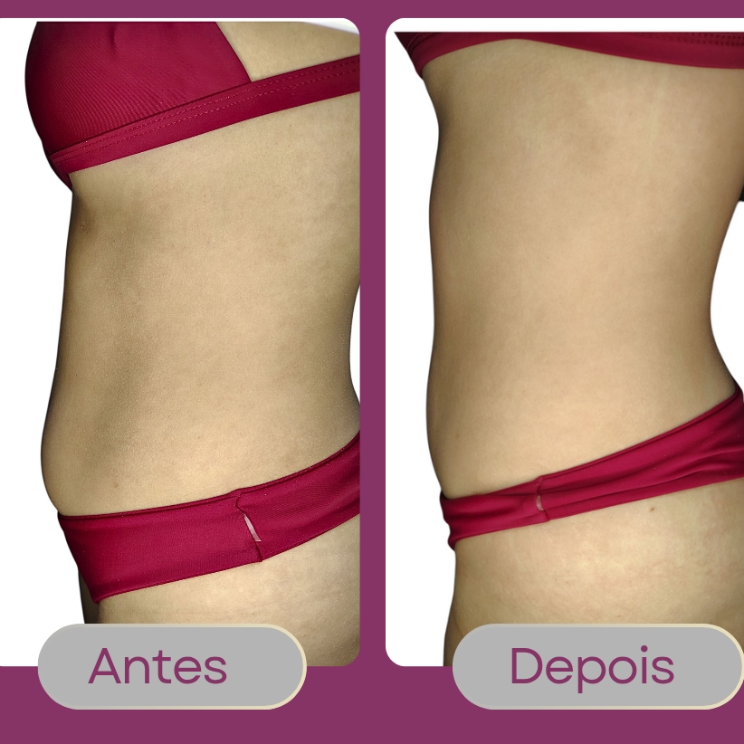 Termoterapia com massagem redutora ou modeladora