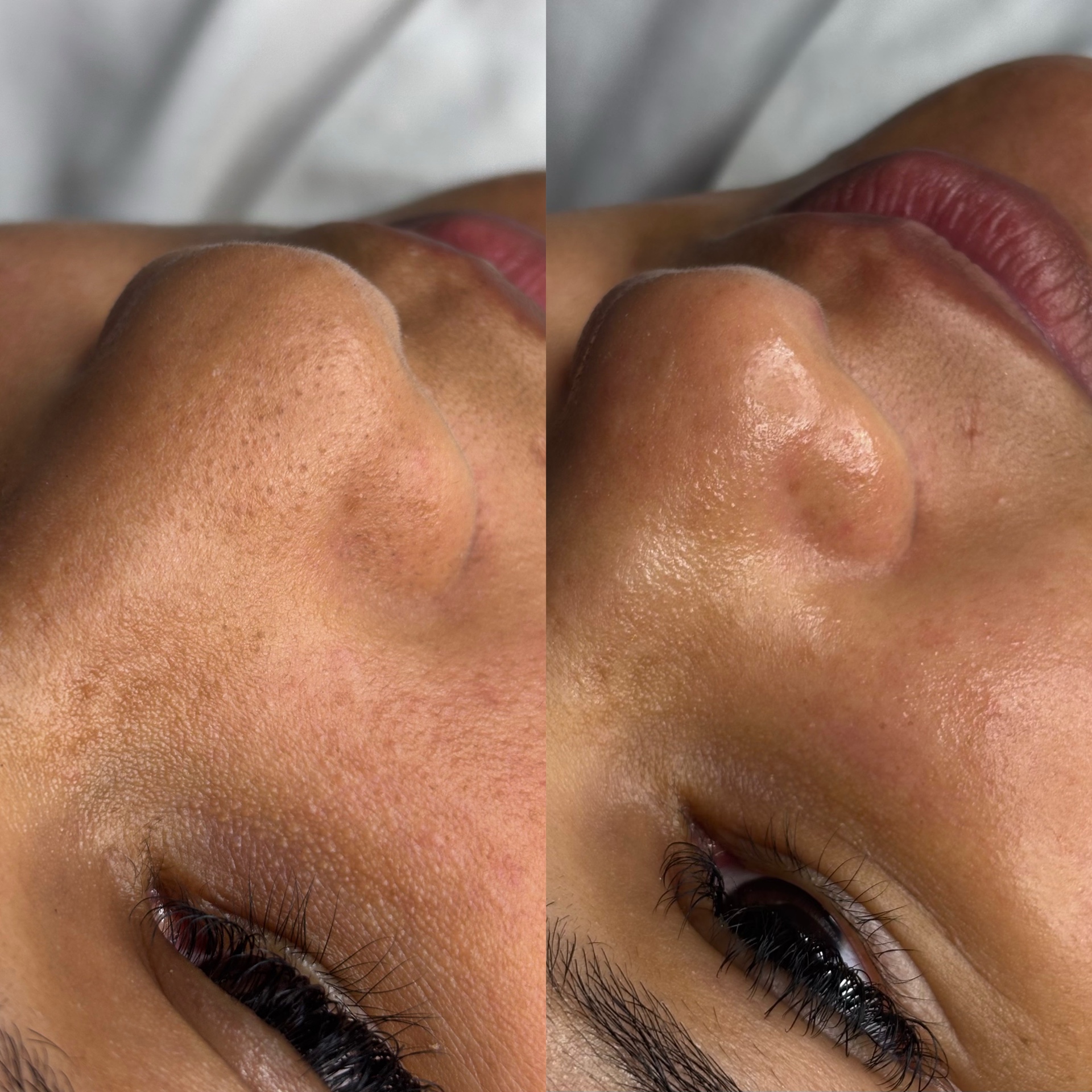 Limpeza de Pele Personalizada