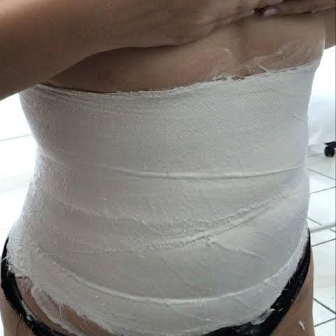 lipoescultura gessada..... para modelar o corpo, reduzir medidas e firmar a pele.