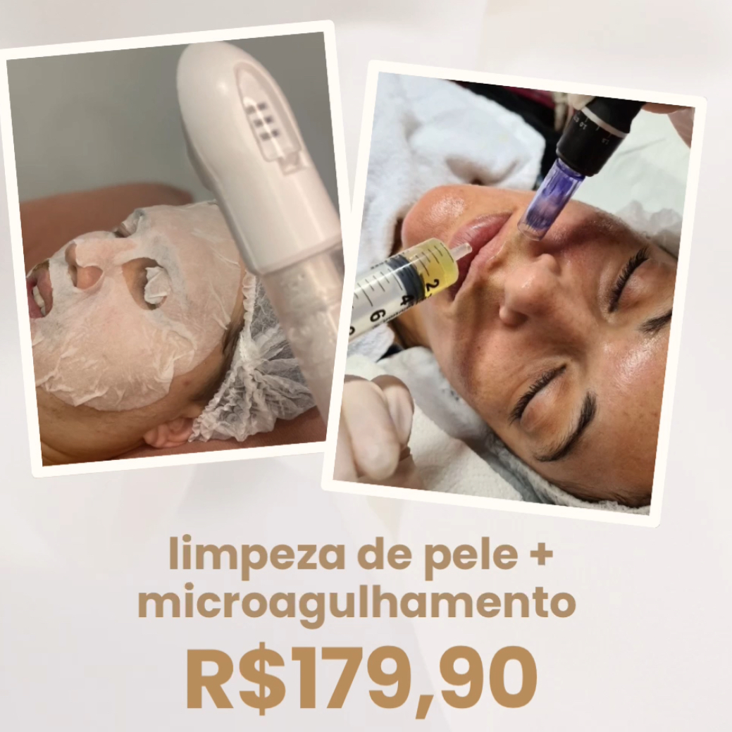 limpeza de pele + microagulhamento
