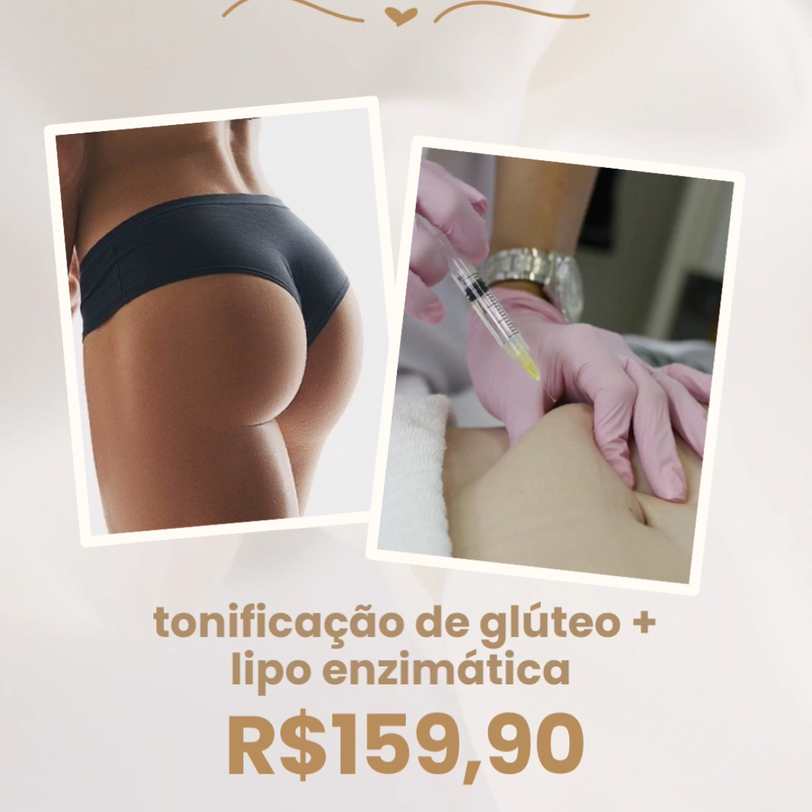 tonificação de glúteo + lipo enzimática
