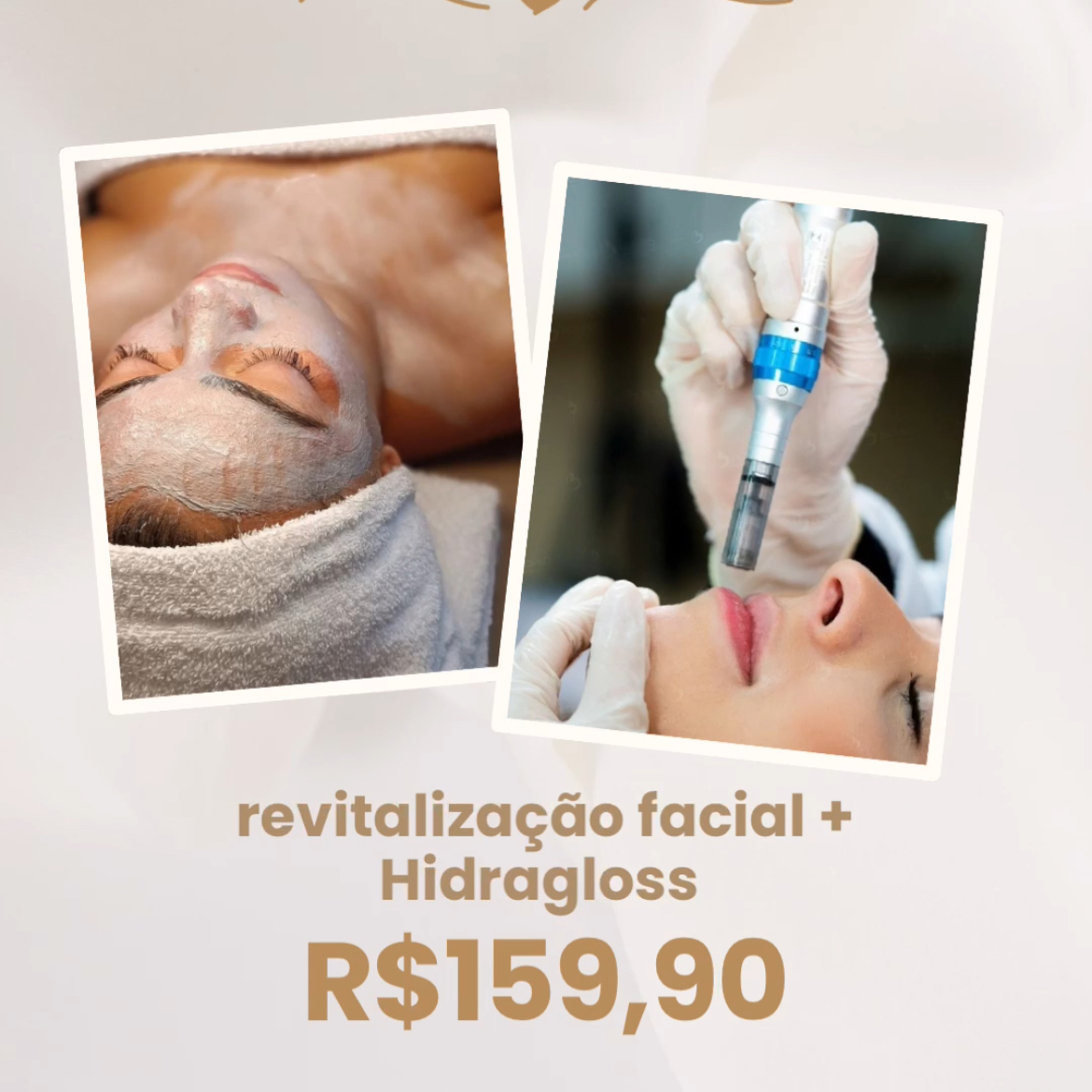 revitalização facial+ hidraglos
