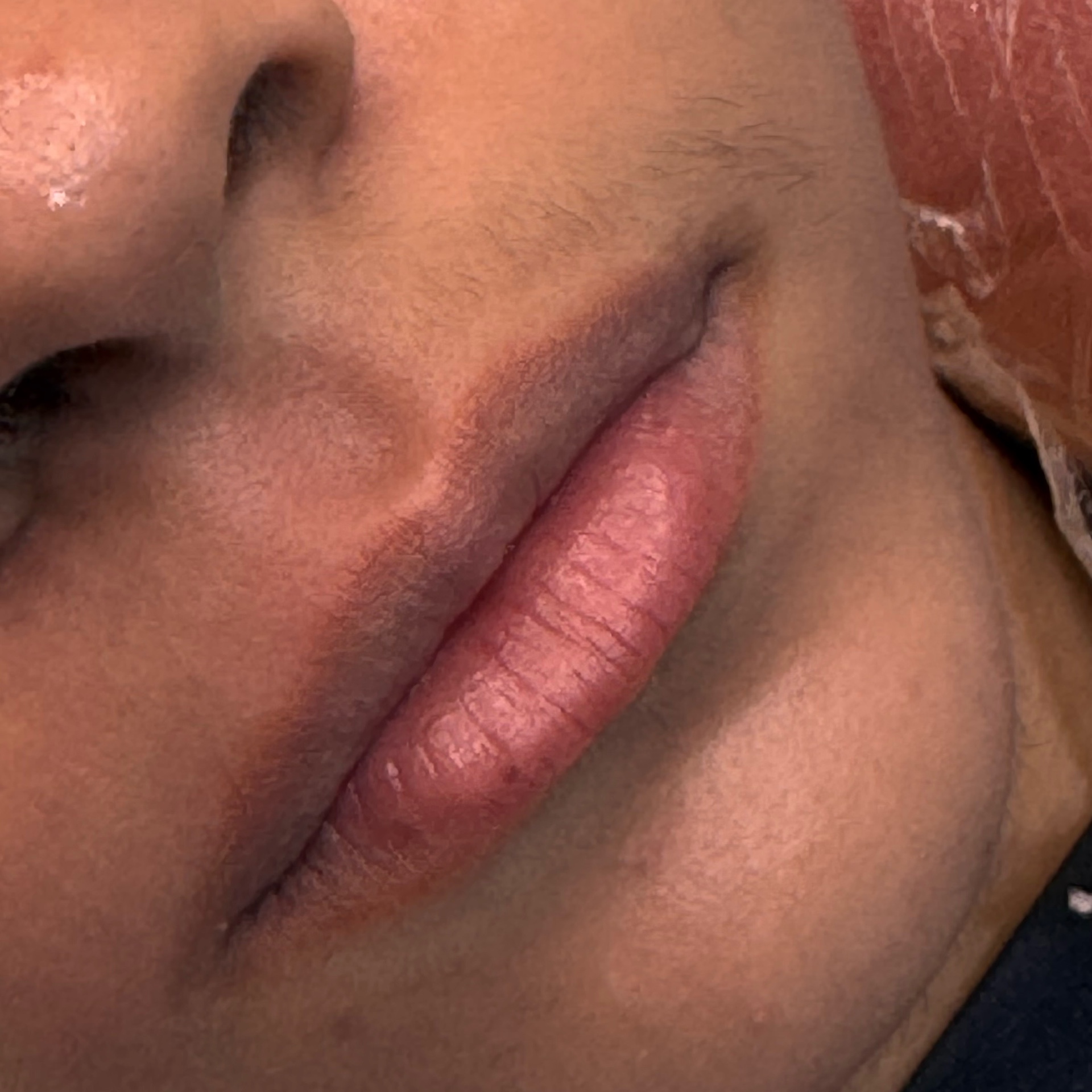 buço