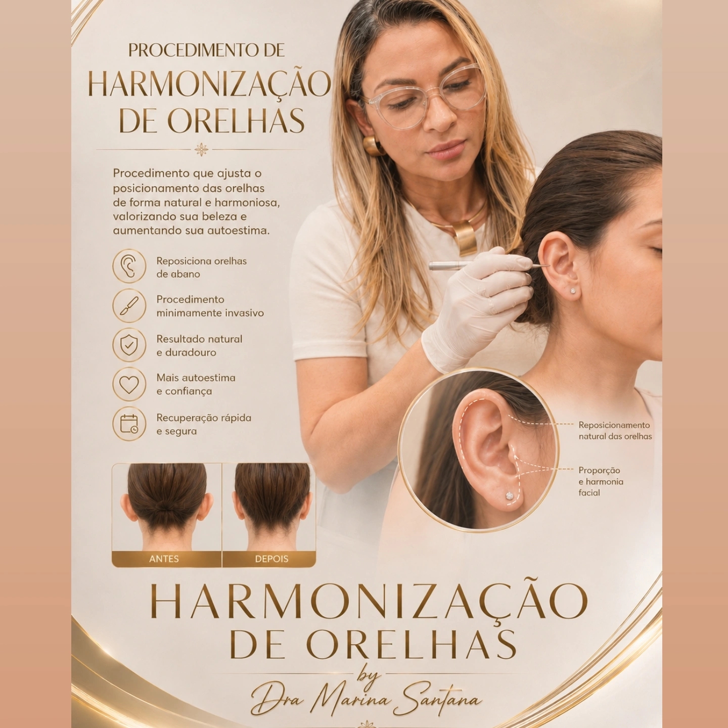 OTOMODELAÇÃO/ Orelha de Abano