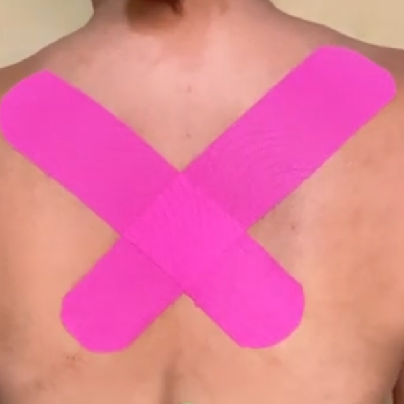 Aplicação de tape por região para dores musculares e edemas