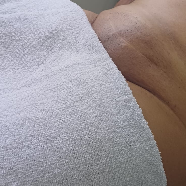 Epilacao Virilha Total