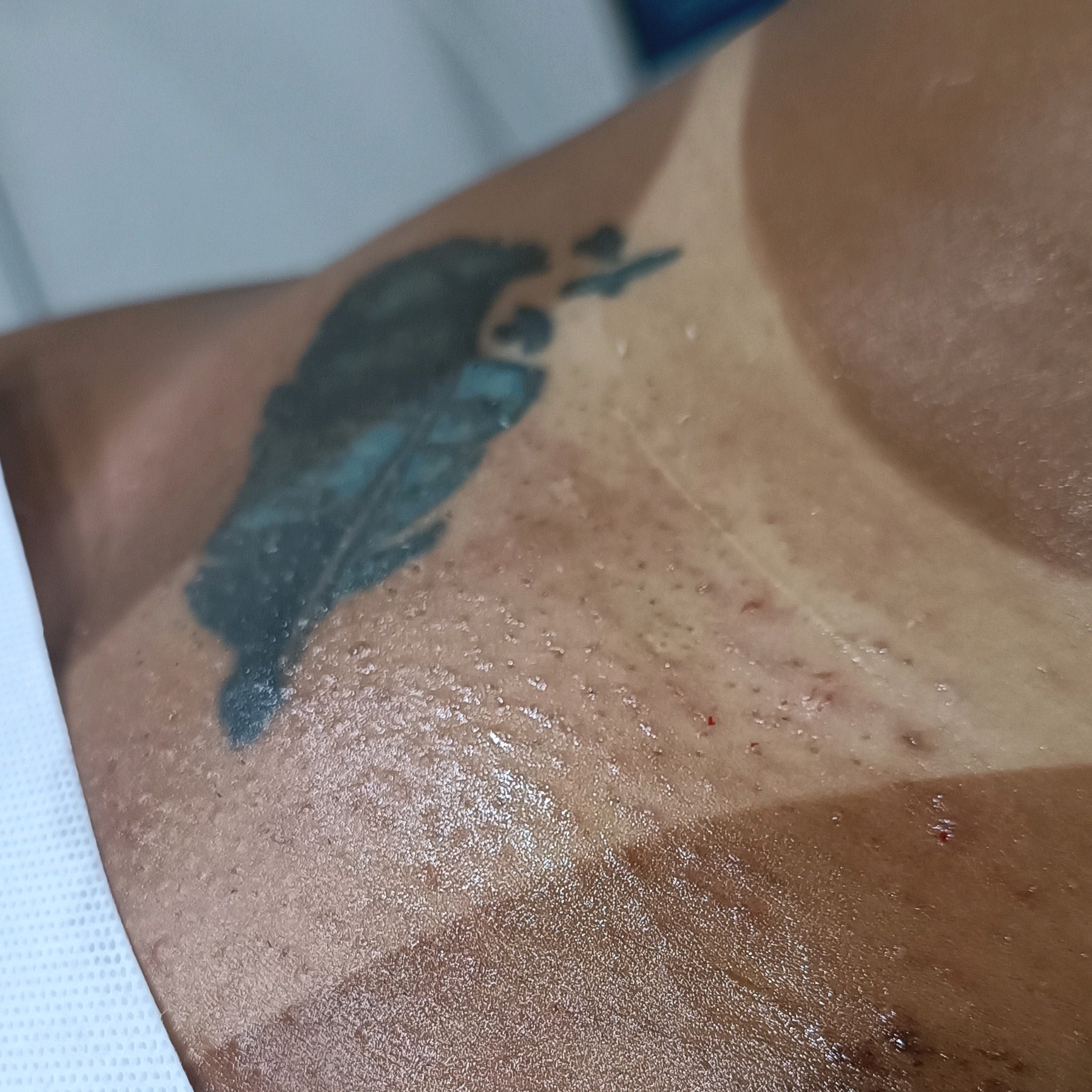 virilha completa