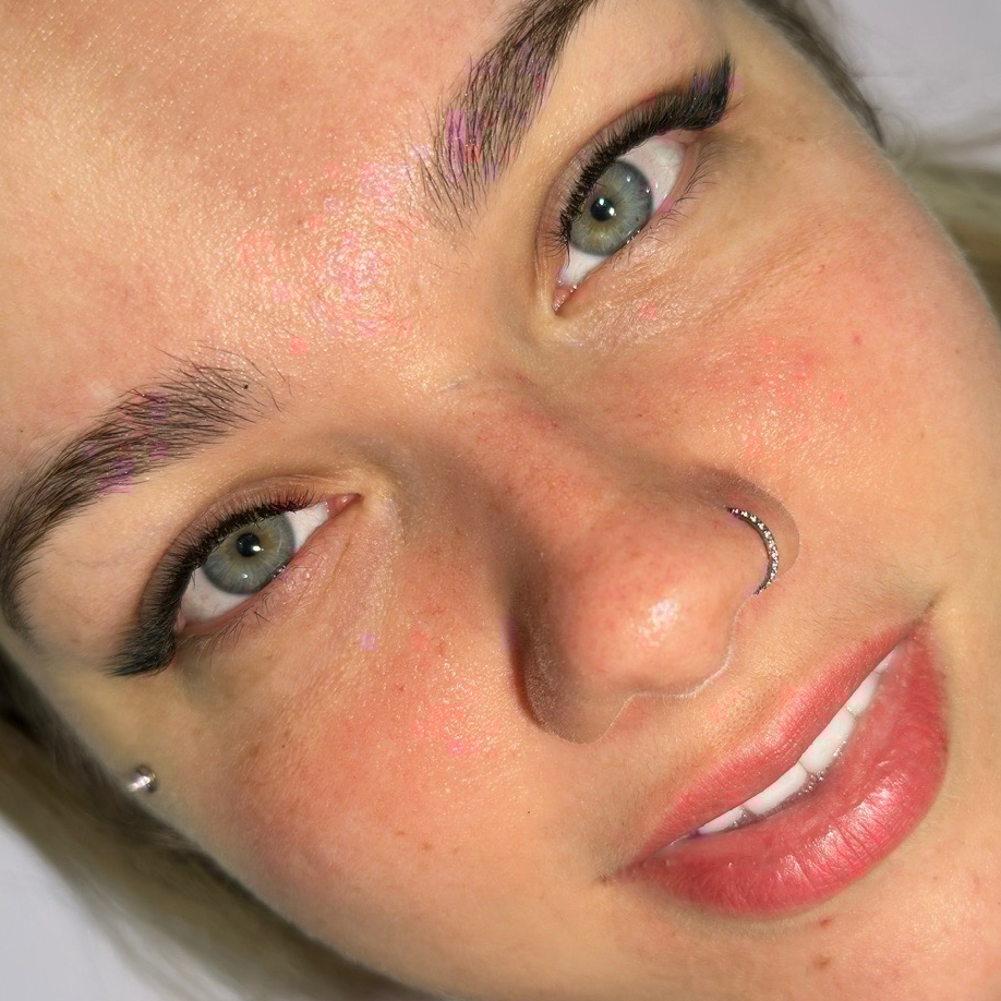 Colocação Fox Eyes