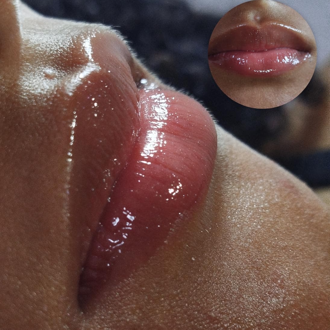 Spa Labial