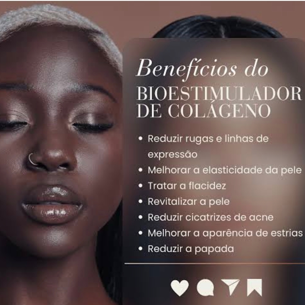 Bioestimuladores de Colágeno Facial