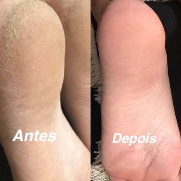 Spa dos Pés