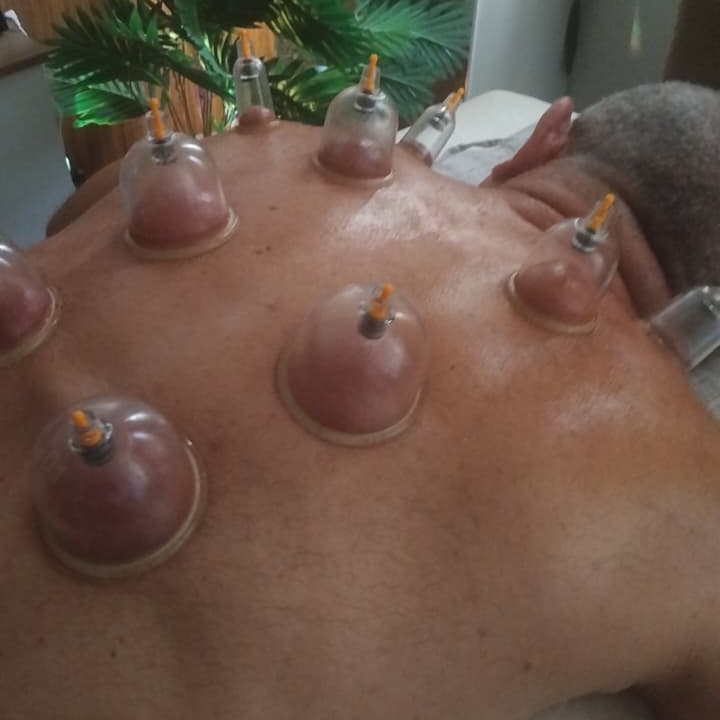 ventosaterapia +relaxante