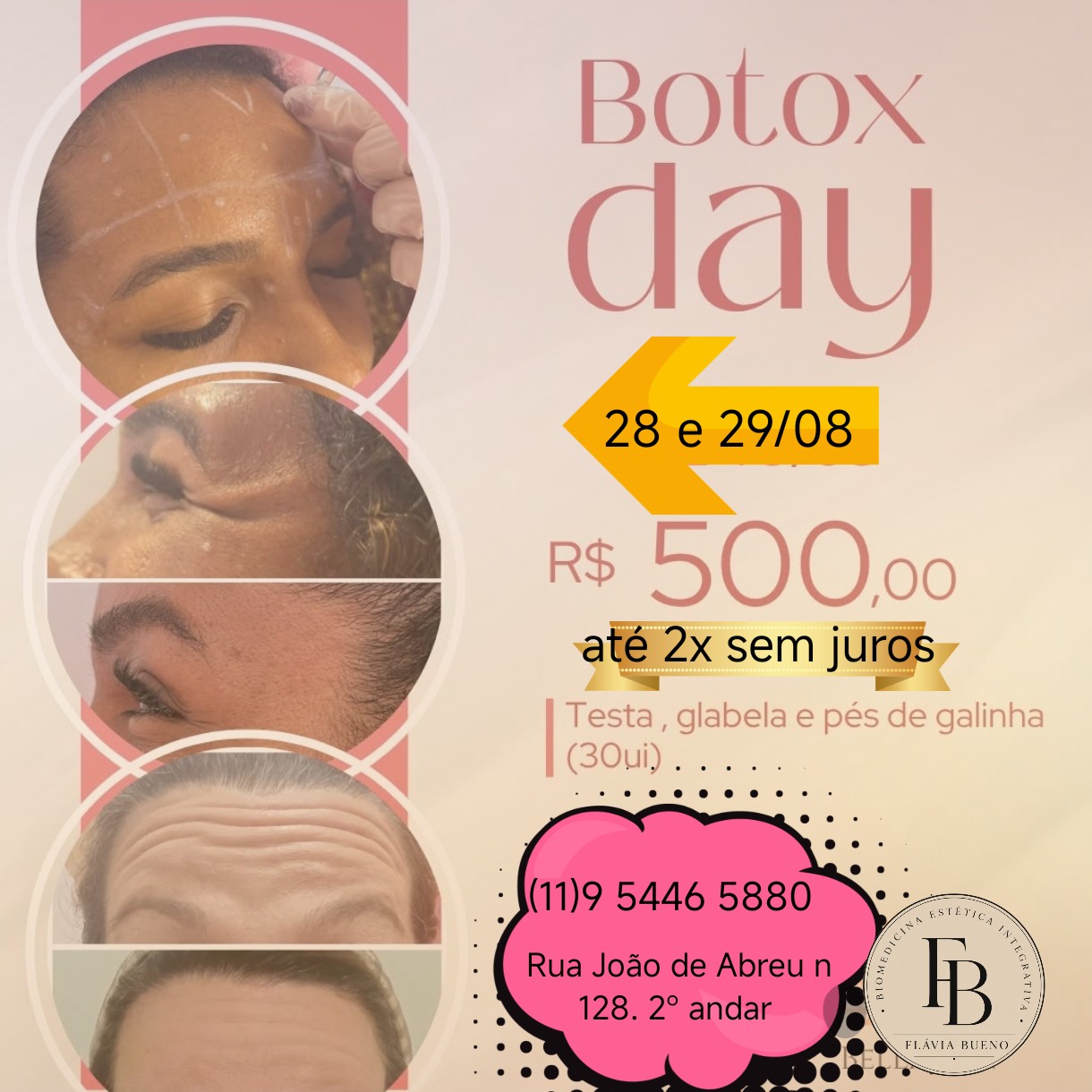 botox day