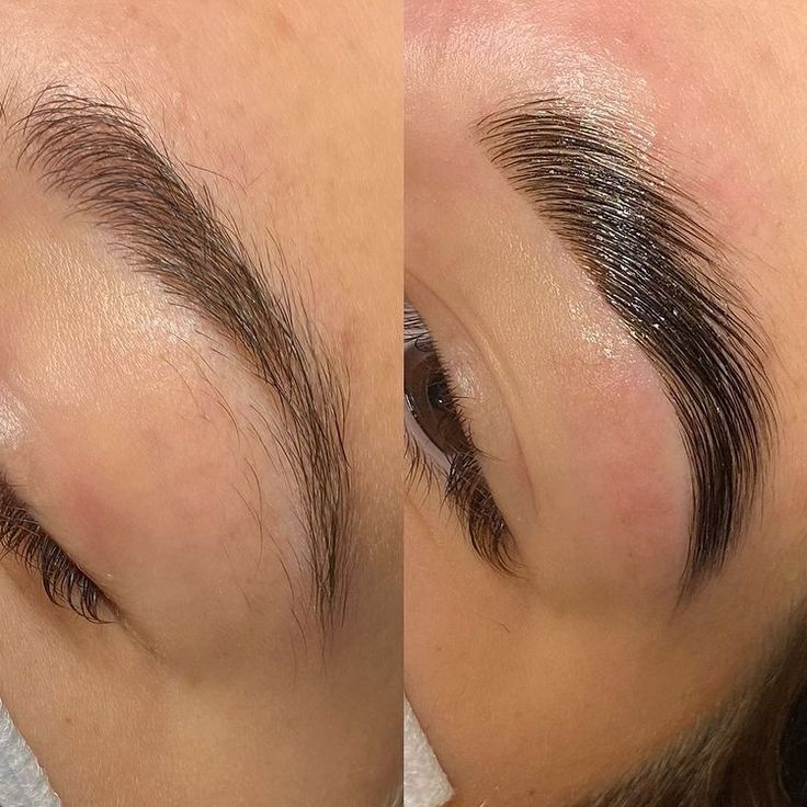 Brow Lamination