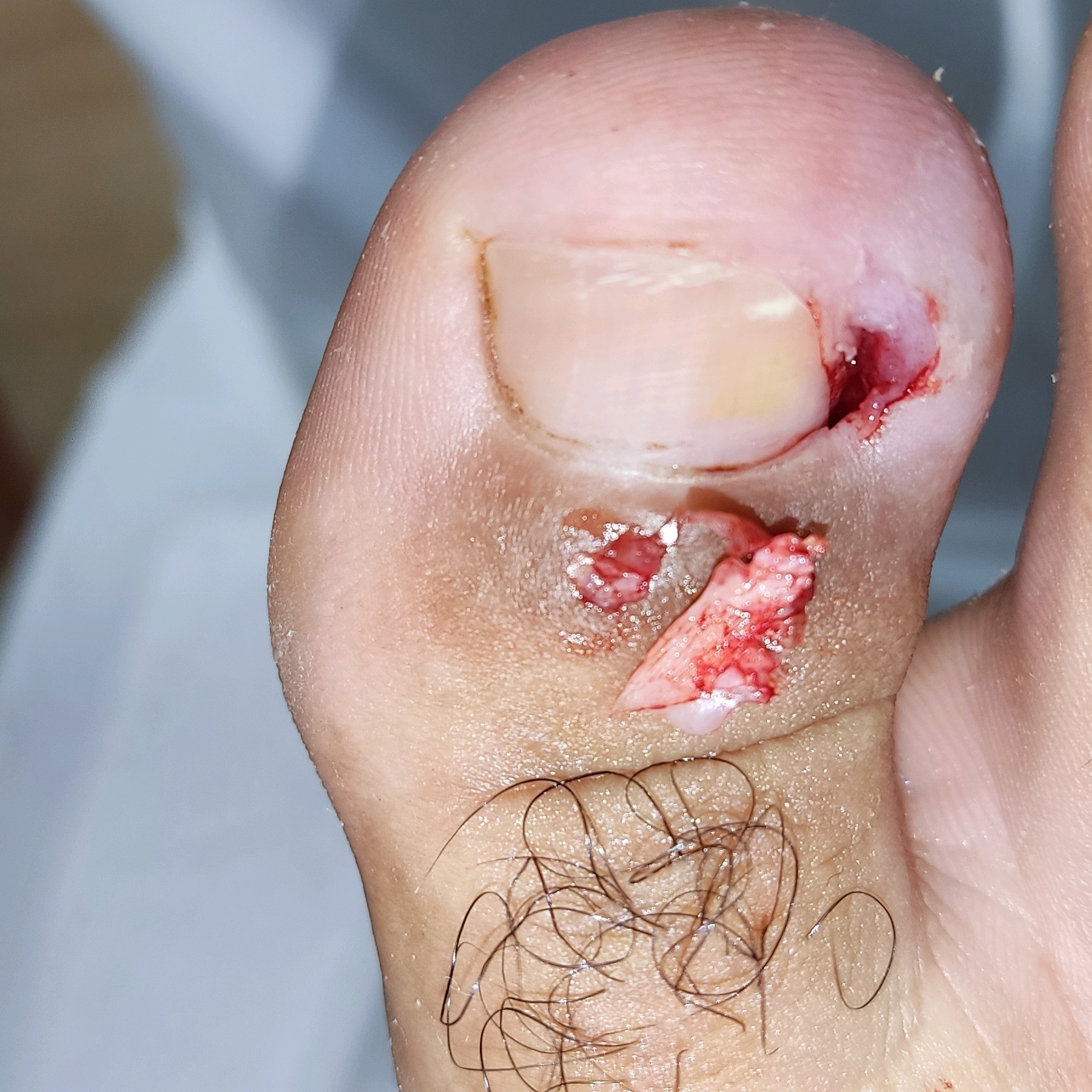 Atendimento podoprofilaxia ( higiene dos pés, lixamento, esfoliação, hidratação,corte reto das unhas, curativo "se necessário" mini kit de curativos em casa.