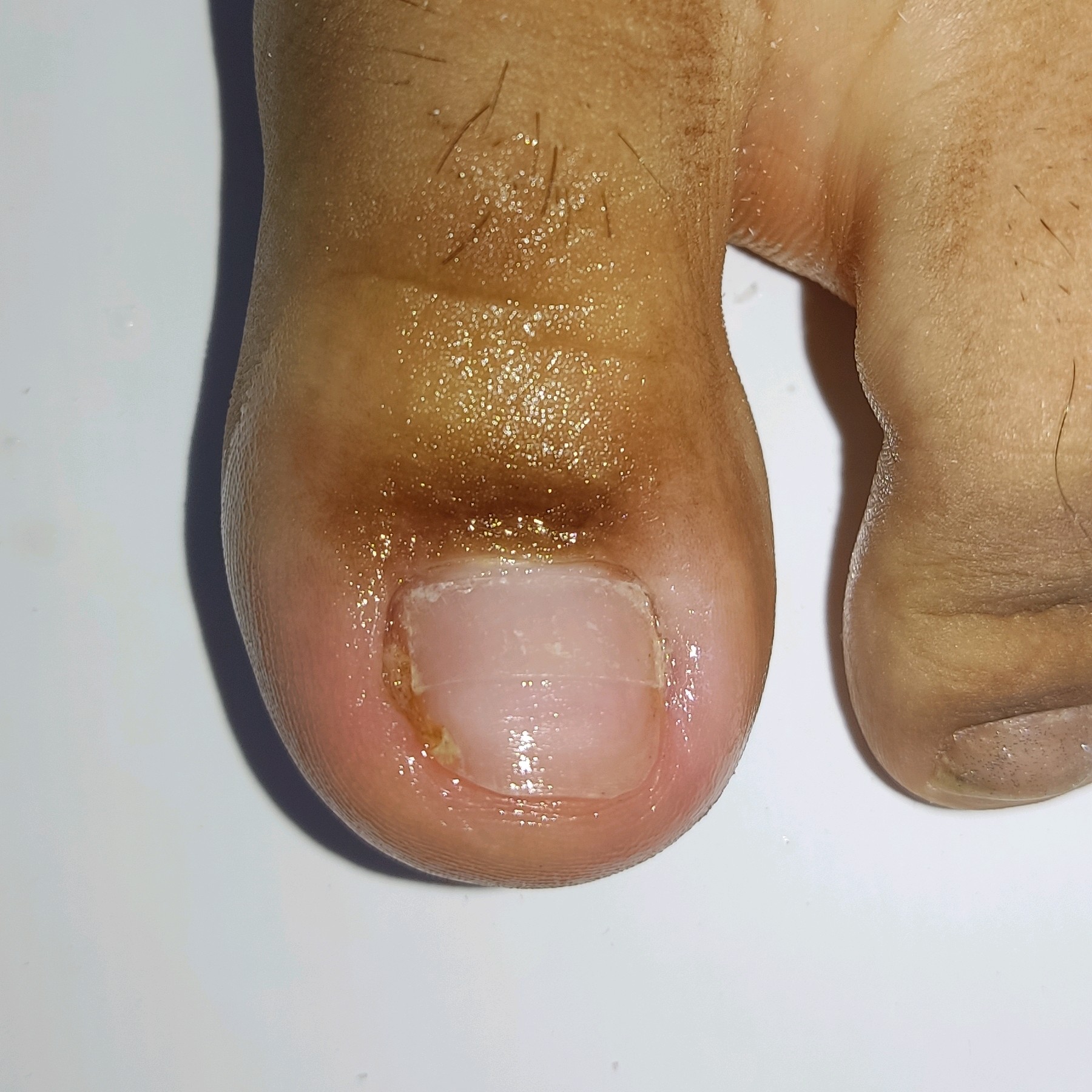 Podocure( corte reto,limpeza das onicomicose, lixamento e esmaltação normal, esfoliação e hidratação dos pés)