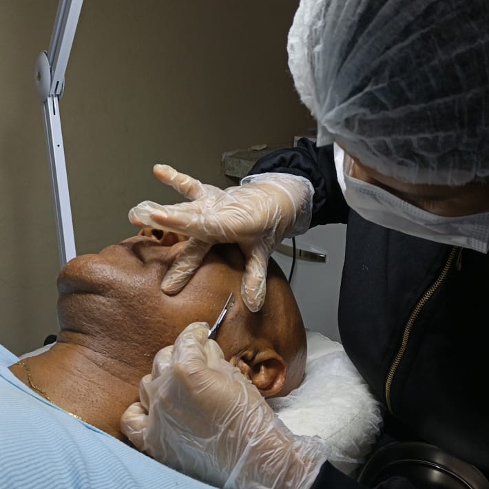 Limpeza de Pele com Dermaplaning