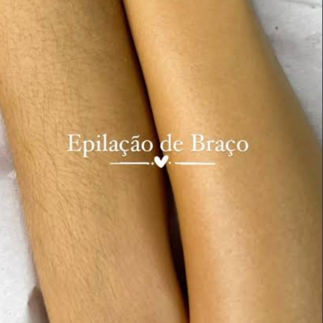 Epilação de Antebraço