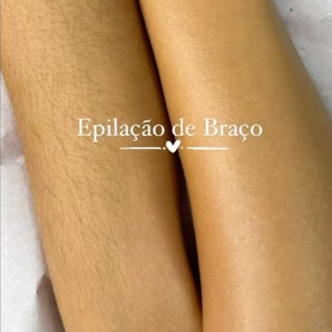 Epilação de Braços
