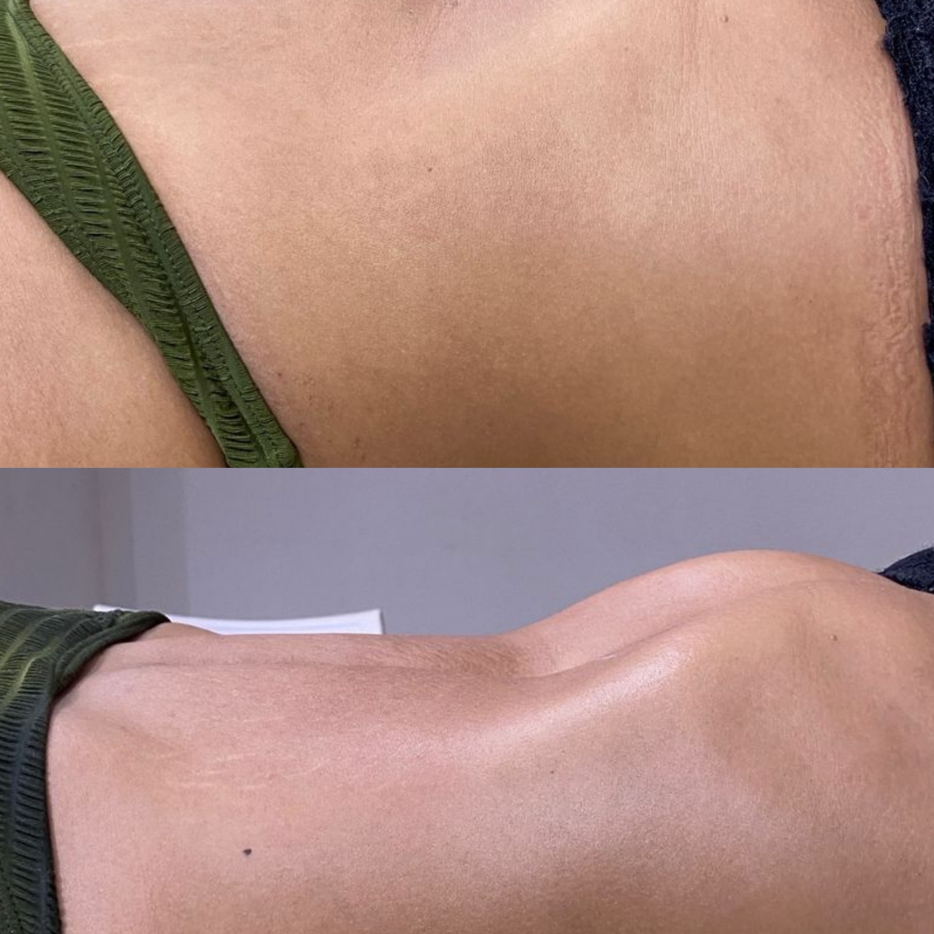 massagem modeladora HD