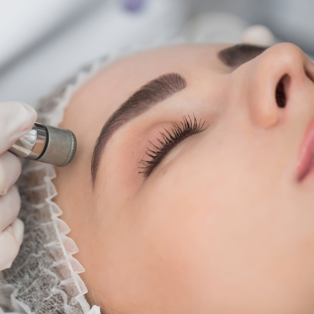 limpeza de pele+peeling de diamante
