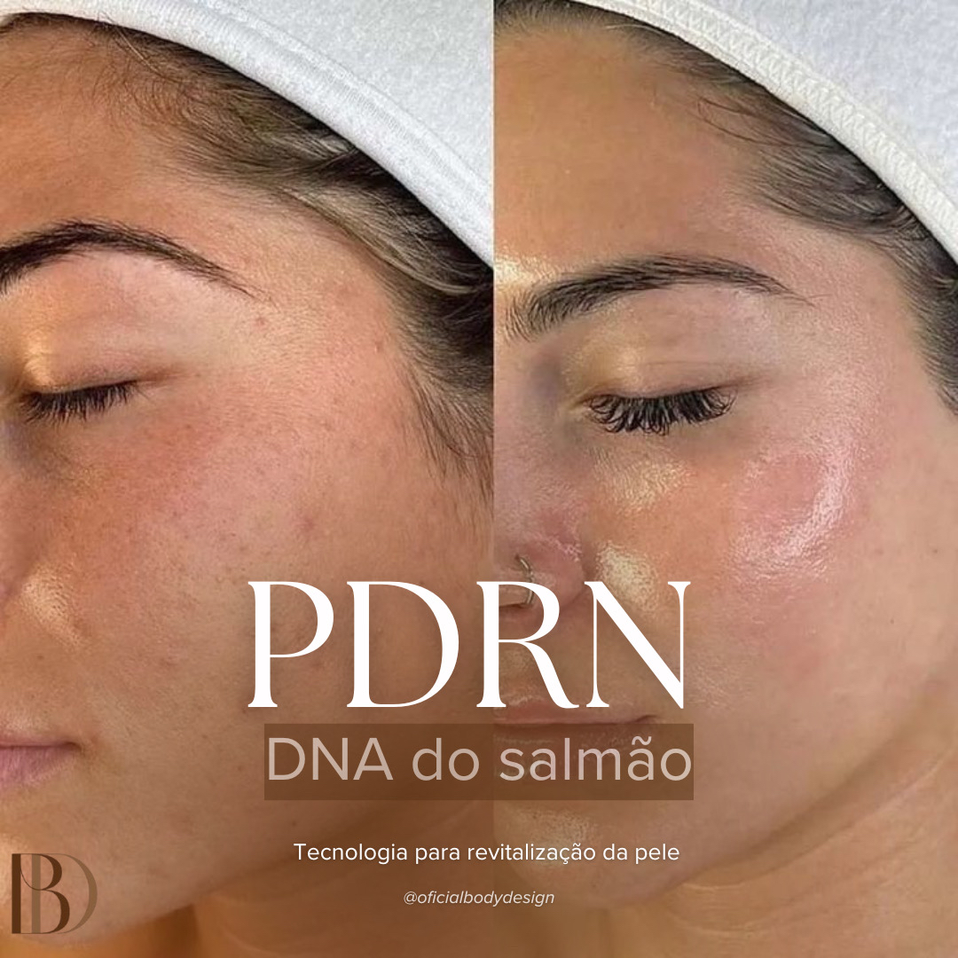 PDRN