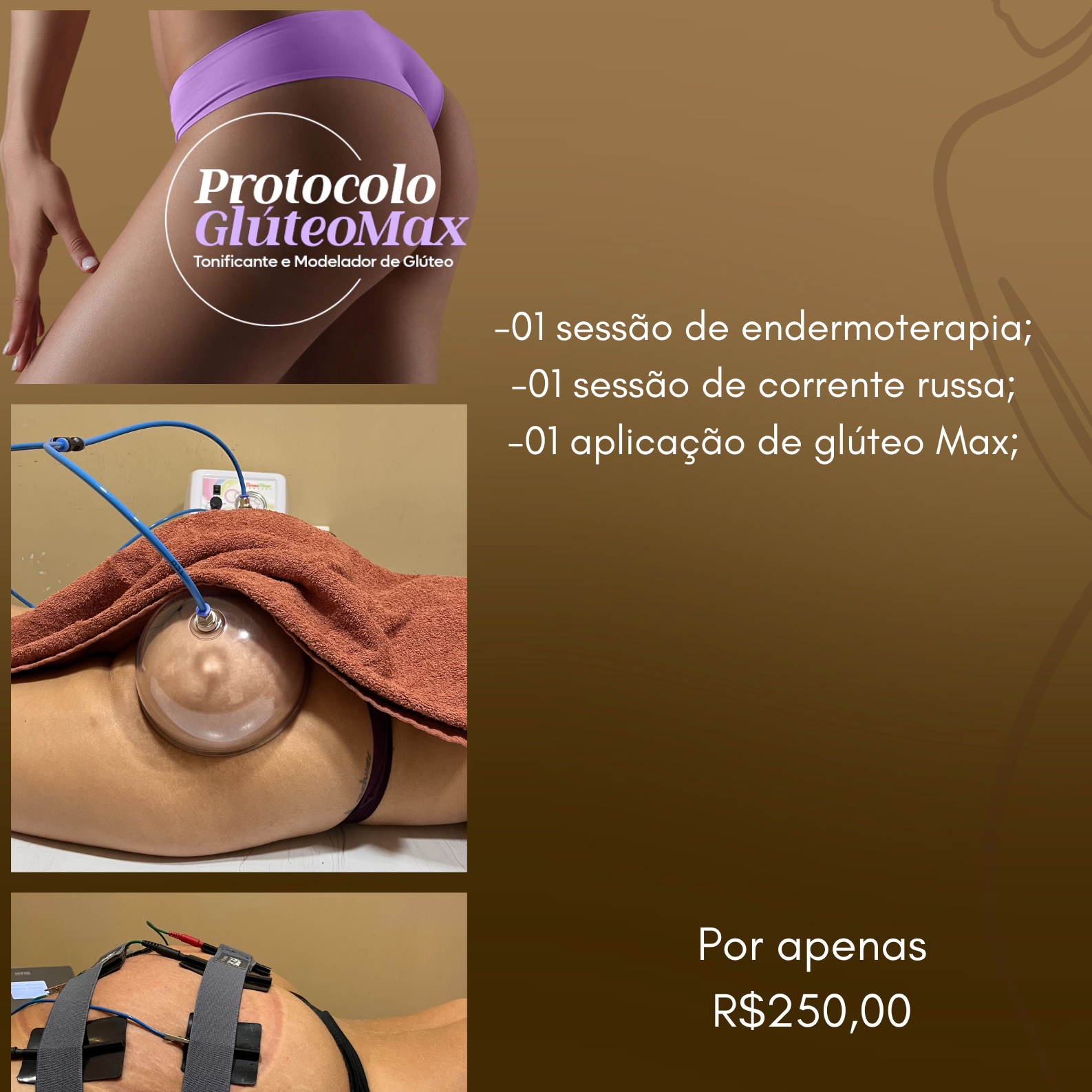 Glúteo Max