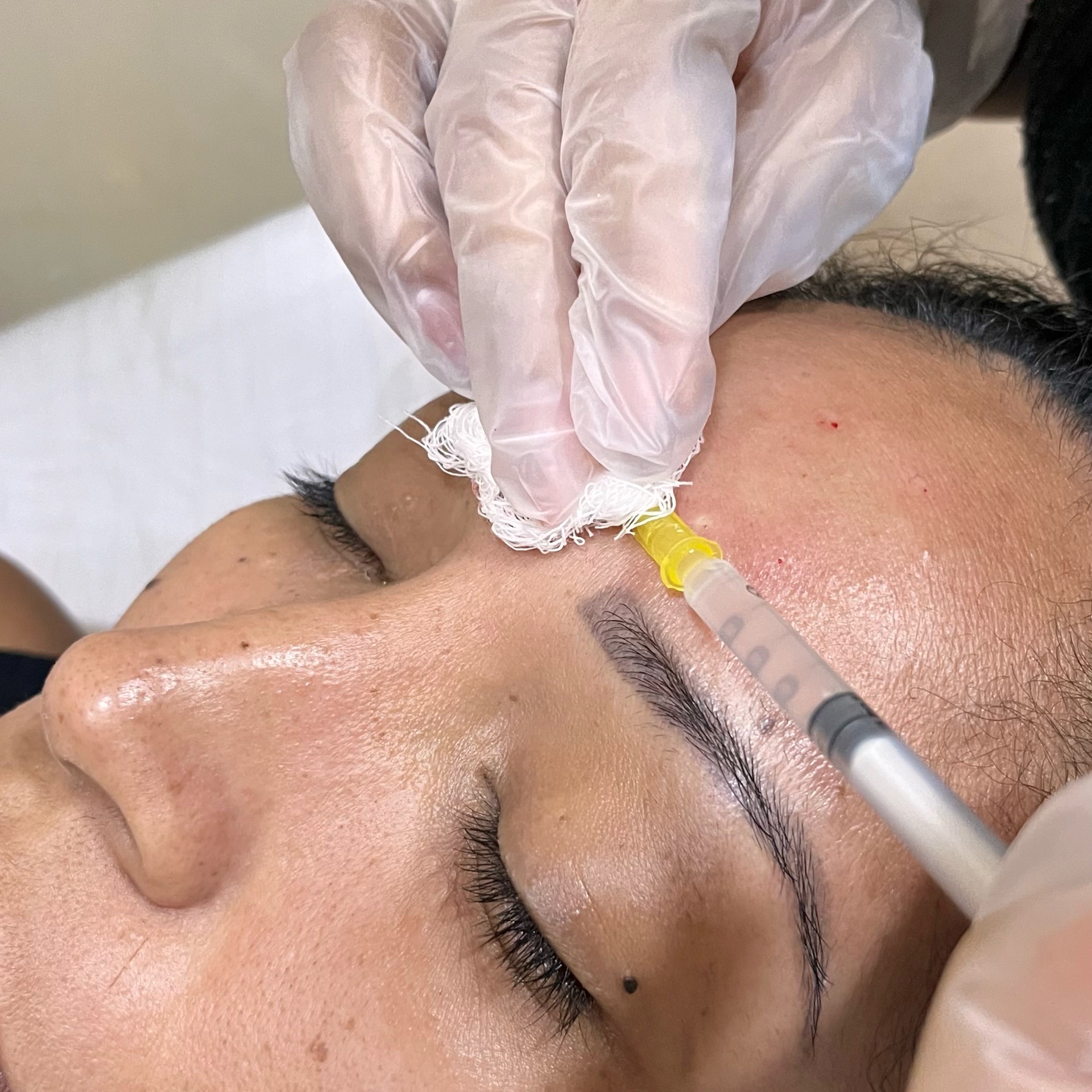 Skinbooster