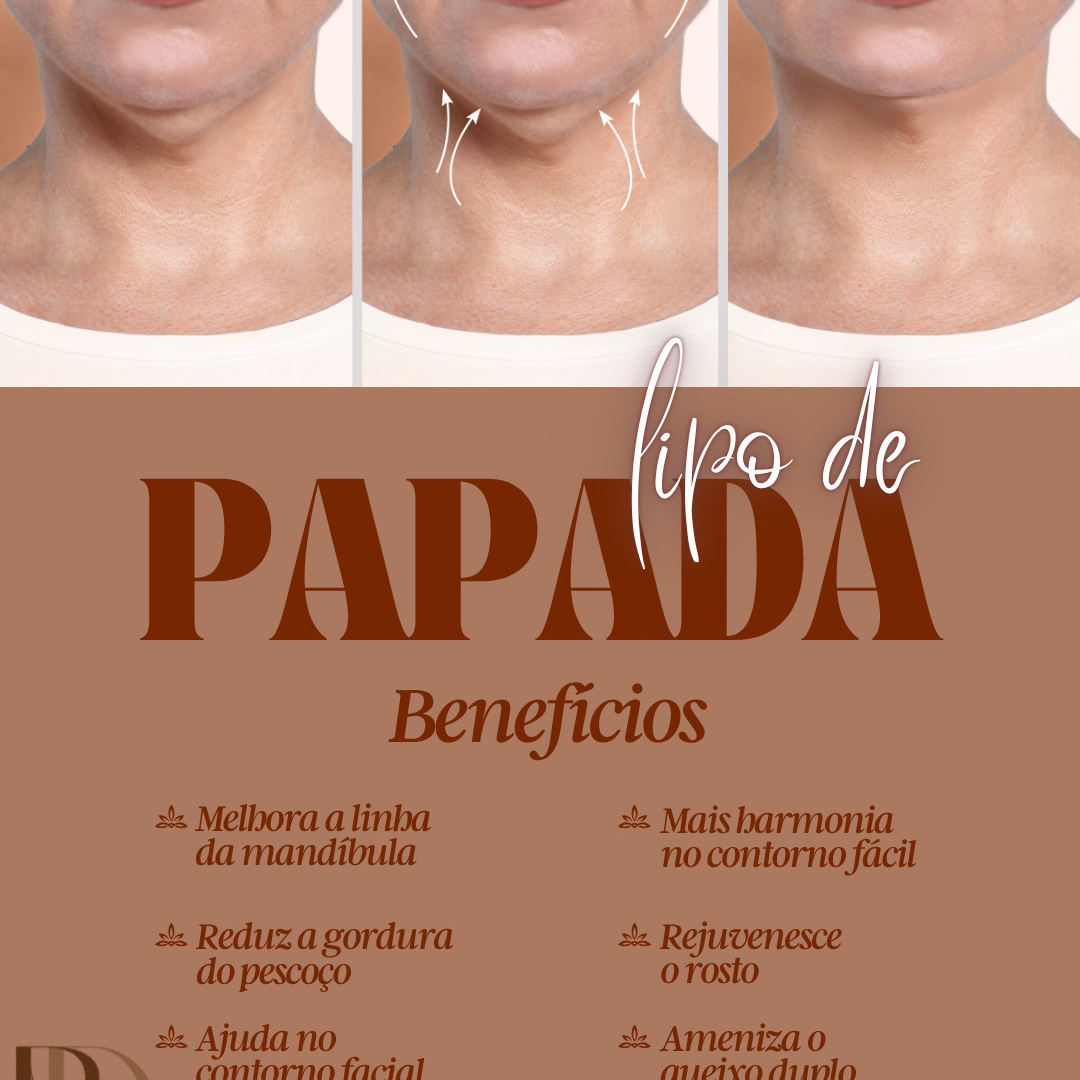 Lipo de papada